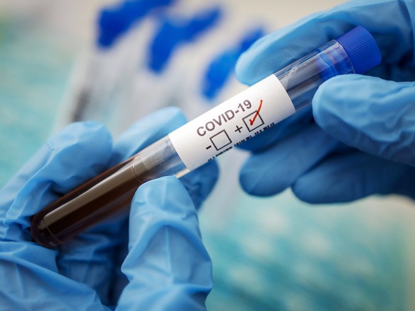 In Ukraine, more than 60-70 thousand cases of COVID-19 are forecast per day